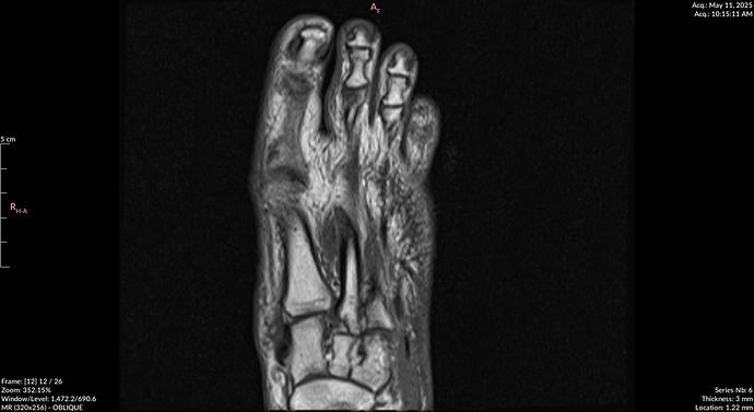 MRI2